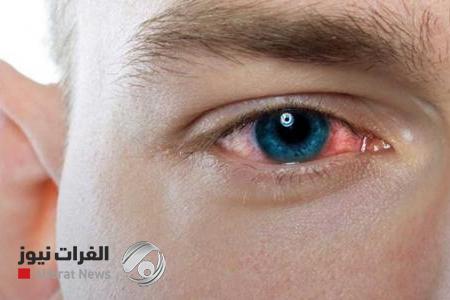 تحذير خطير.. العلاقة بين رعشة العين والاصابة بالسرطان