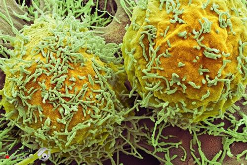 علماء يكتشفون دواء لسرطان الرئة